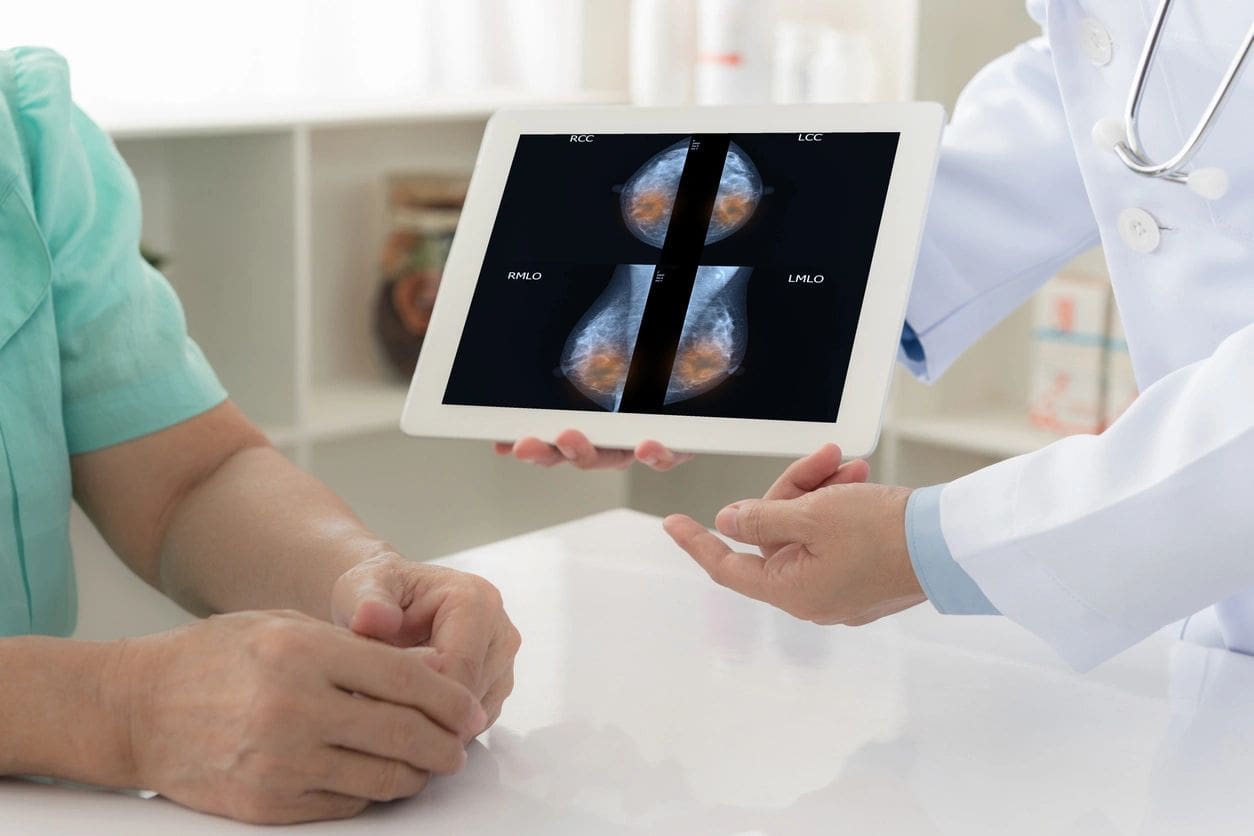 breast cancer concept. doctor explain mammogram results of breast test from x-ray scan on digital tablet screen to patient. (breast cancer concept. doctor explain mammogram results of breast test from x-ray scan on digital tablet screen to patient., A